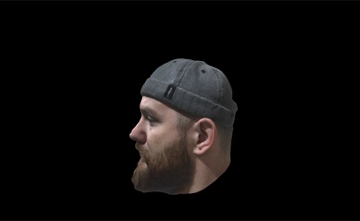 Craniofacial Planning